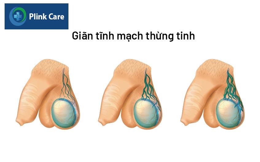 tổng quan về bệnh