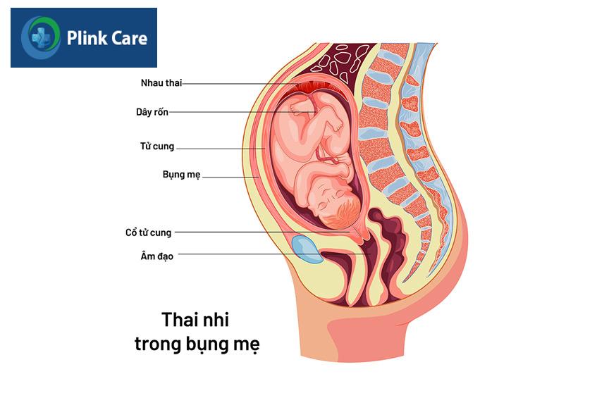 tử cung bị vỡ khi sinh