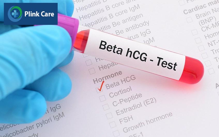 vì sao cần phải xét nghiệm hcg