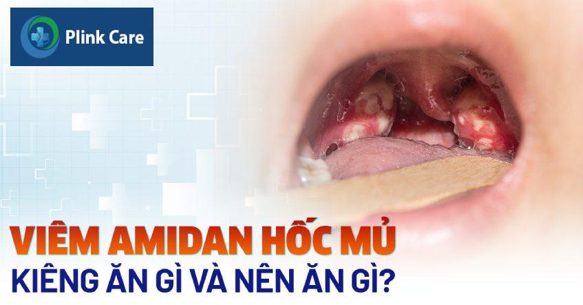 viêm amidan hốc mủ kiêng ăn gì