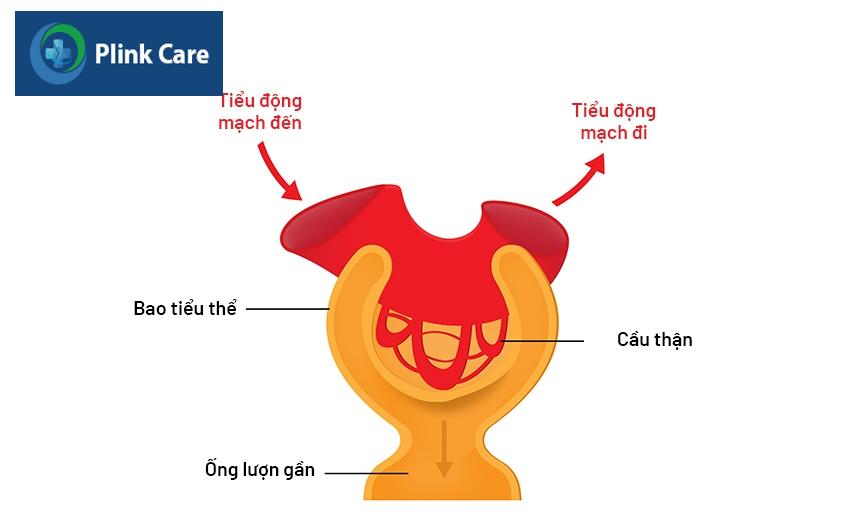 viêm cầu thận cấp là gì