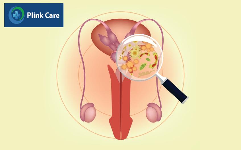 viêm tuyến tiền liệt cấp tính là gì
