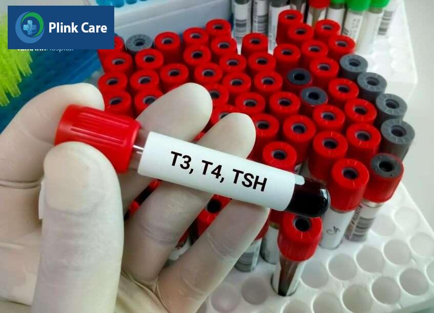 xét nghiệm đánh giá mức độ bướu cổ
