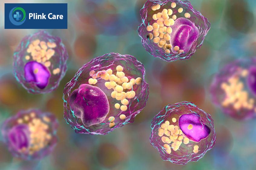 xét nghiệm triglyceride chẩn đoán bệnh gì