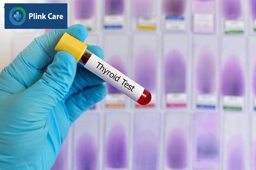 xét nghiệm xác định nồng độ hormone trong máu