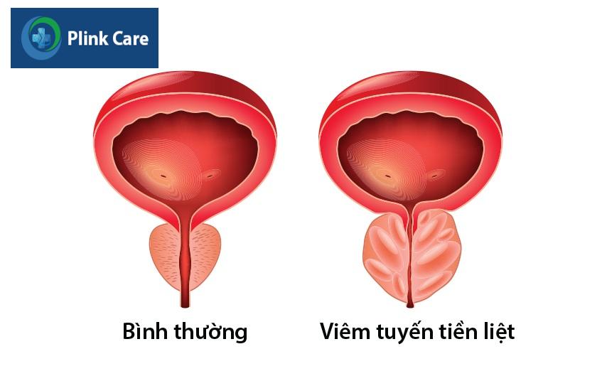 yếu tố nguy cơ 
