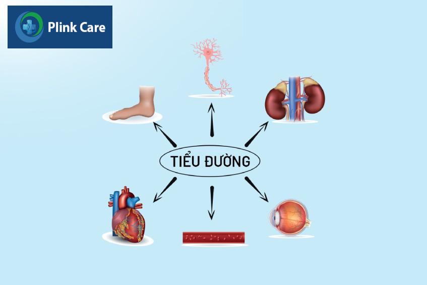 bệnh tiểu đường tuýp 2 kéo dài suốt đời