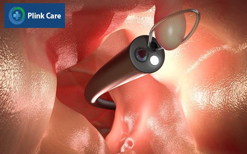 bị polyp dạ dày