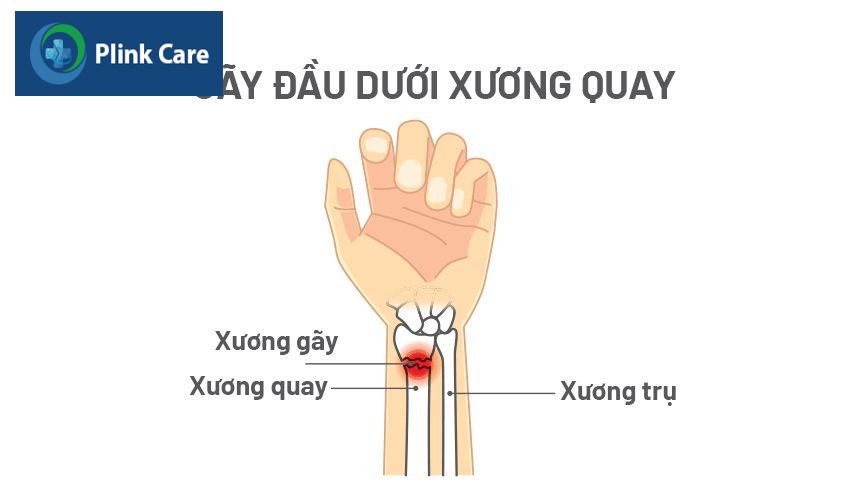 cấu tạo xương quay cổ tay