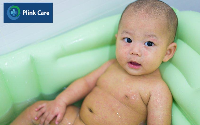chăm sóc trẻ bị sốt phát ban