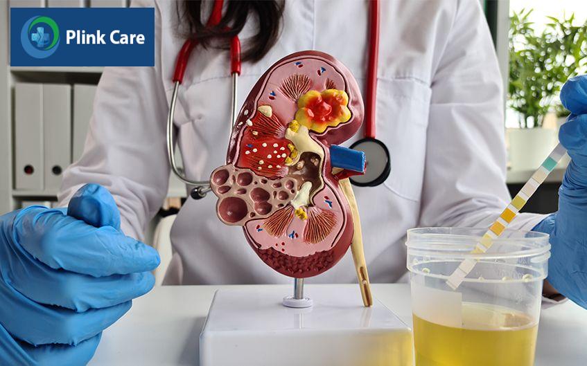 chẩn đoán viêm cầu thận mạn tính
