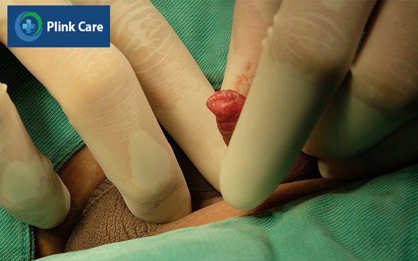 có nên tự chữa hẹp bao quy đầu ở nhà không