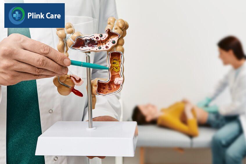 dấu hiệu ung thư đại tràng giai đoạn 4