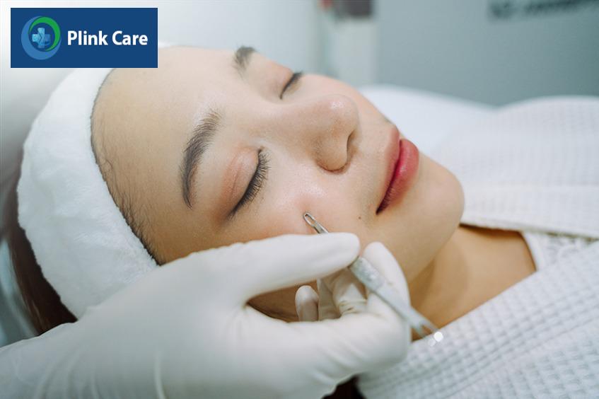 điều trị mụn trứng cá ở cằm