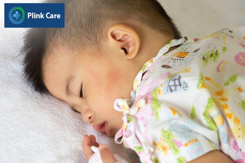 điều trị tại cơ sở y tế