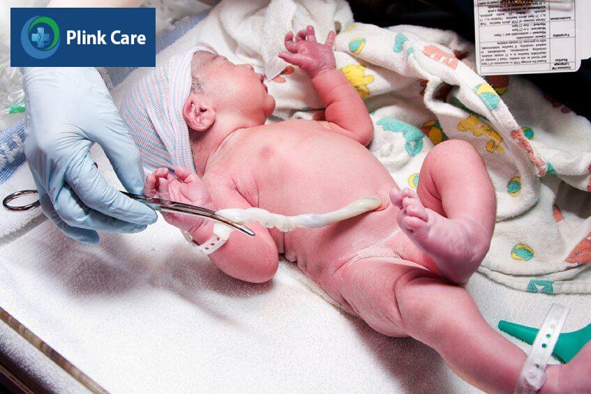 loại tế bào gốc từ dây rốn