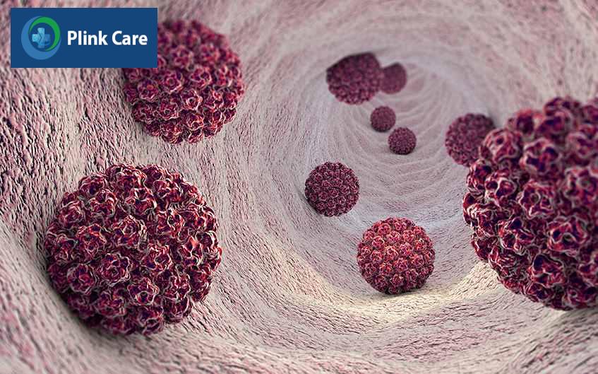 virus hpv
