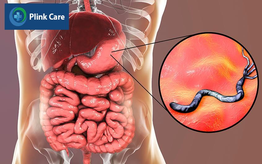nguyên nhân gây viêm niêm mạc dạ dày