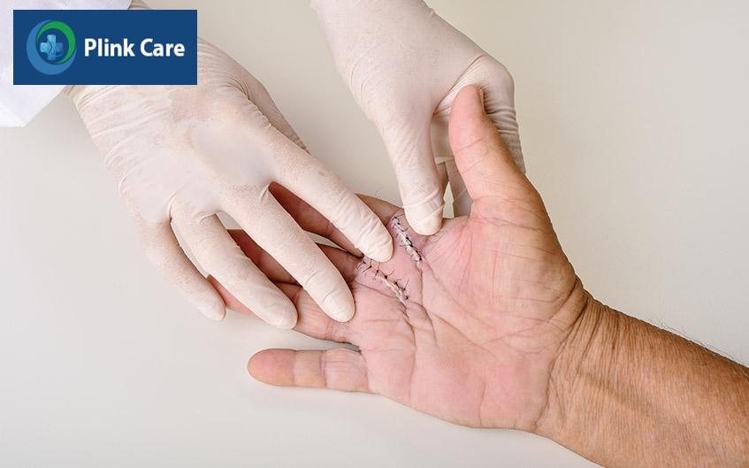 phục hồi chức năng cho ngón tay