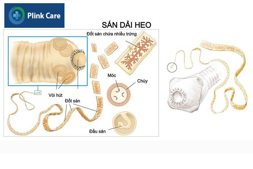 sán dải heo