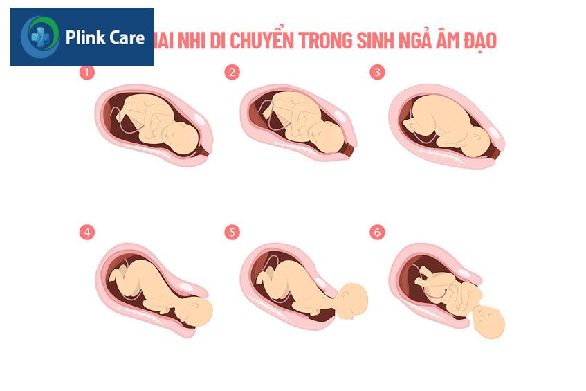 sinh ngã âm đạo