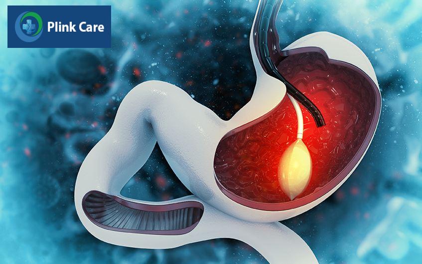 triệu chứng rối loạn tiêu hóa