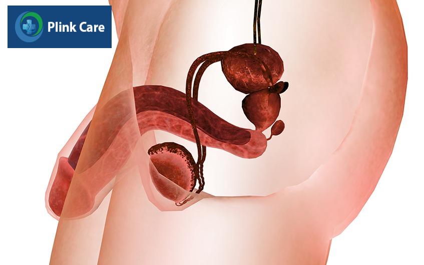 vì sao cần phát hiện sớm ung thư dương vật