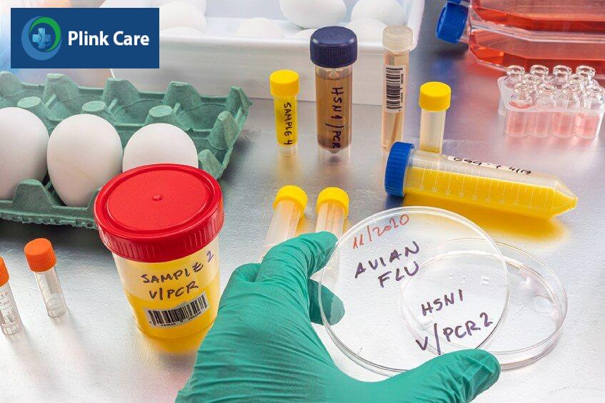 xét nghiệm chẩn đoán cúm a h5n1