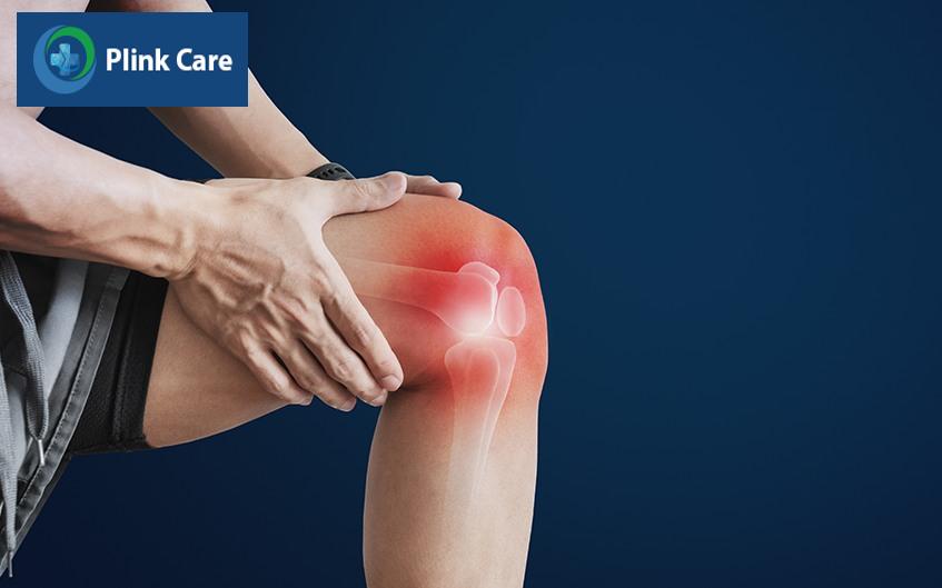 ai cần chụp x-quang khớp gối