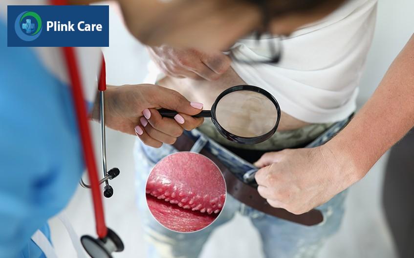 chẩn đoán chuỗi hạt ngọc dương vật