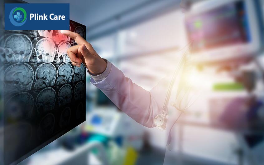 chẩn đoán điều trị tai biến mạch máu não