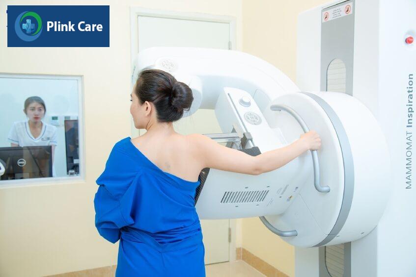 chụp nhũ ảnh tầm soát giai đoạn 1 ung thư vú