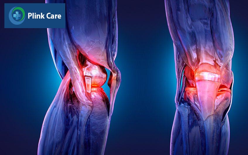 X-quang chẩn đoán ung thư xương khớp gối