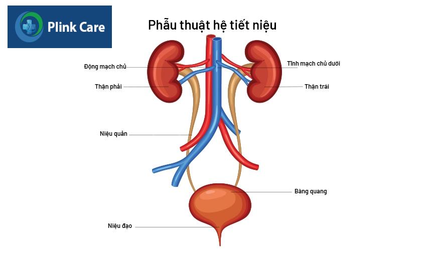 đái ra máu là gì