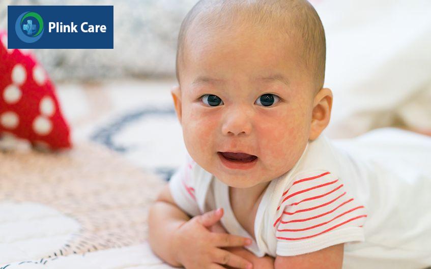 Sởi là một căn bệnh truyền nhiễm cấp tính