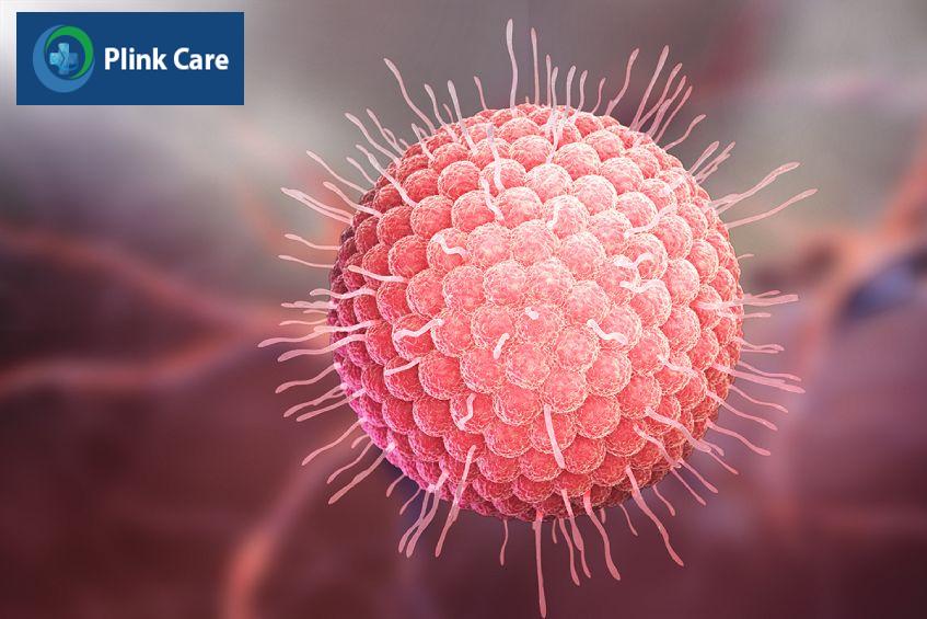 Thủy đậu là bệnh gây ra do virus Varicella Zoster