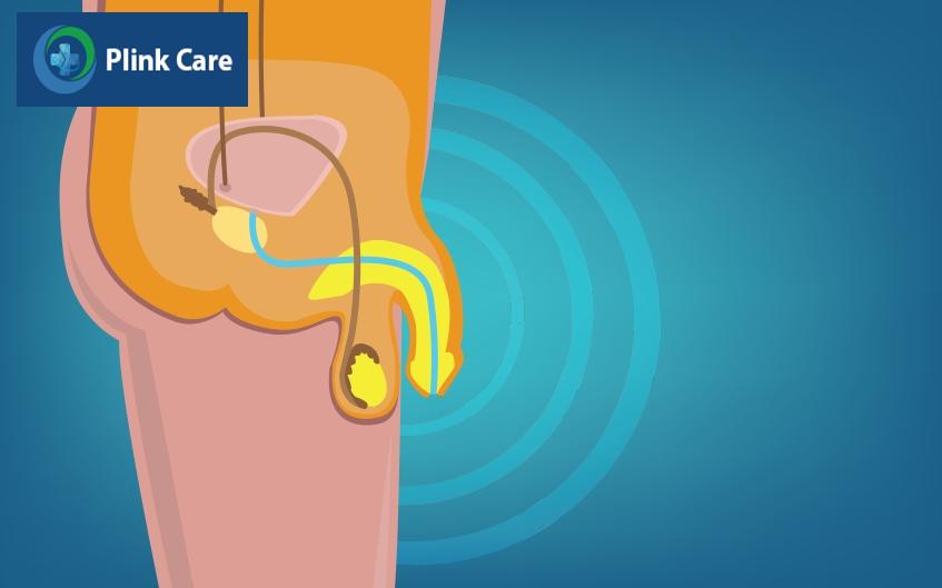 tổng quan về rối loạn cương dương