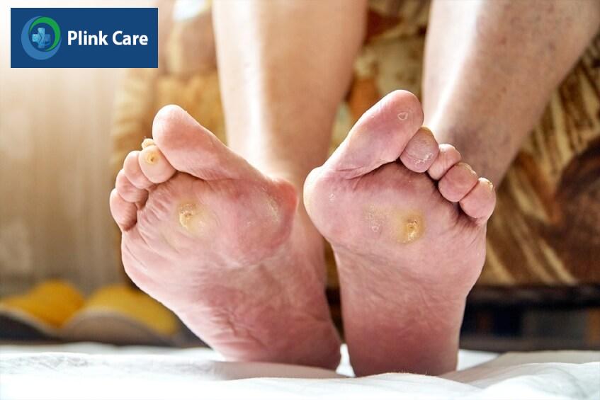 ứng dụng tế bào gốc điều trị tiểu đường