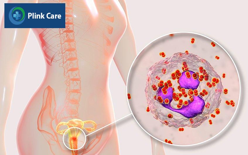 con đường lây nhiễm bệnh lậu ở nữ giới