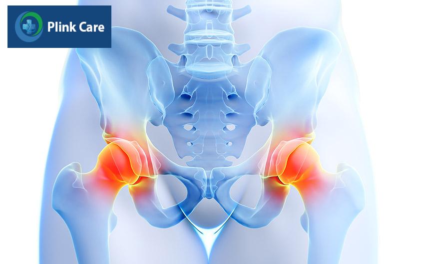 khớp háng bị co cứng