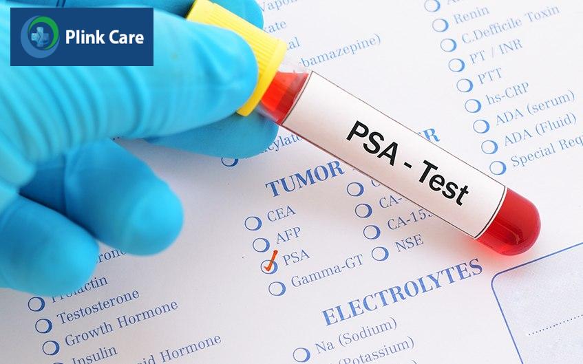 psa test
