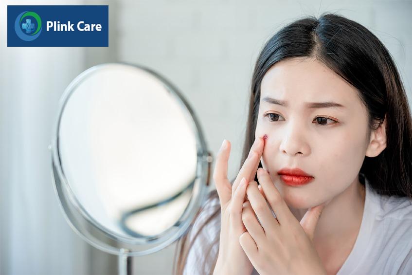 thay đổi chế độ ăn uống