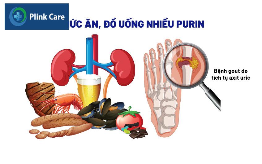thức ăn chứa nhiều purin