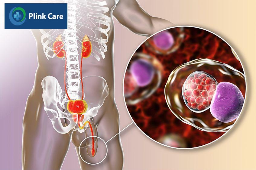 Chlamydia phổ biến như thế nào