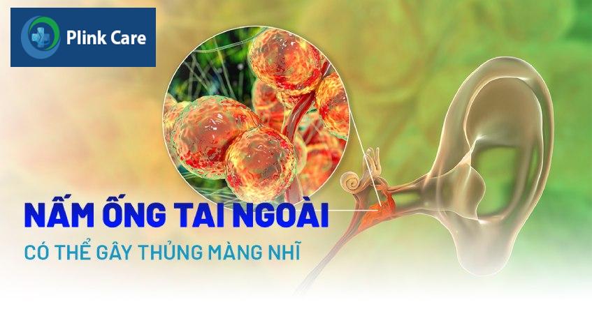 bệnh nấm ống tai ngoài