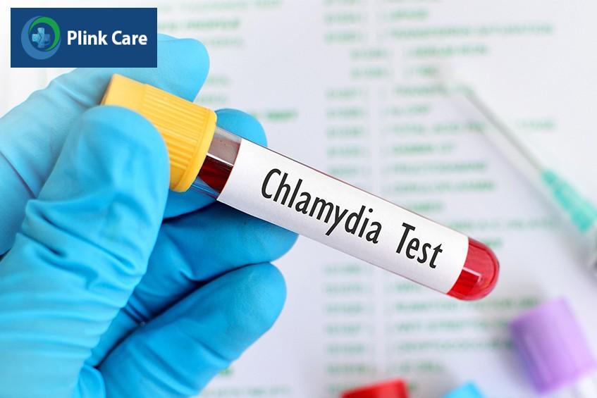 Chlamydia test