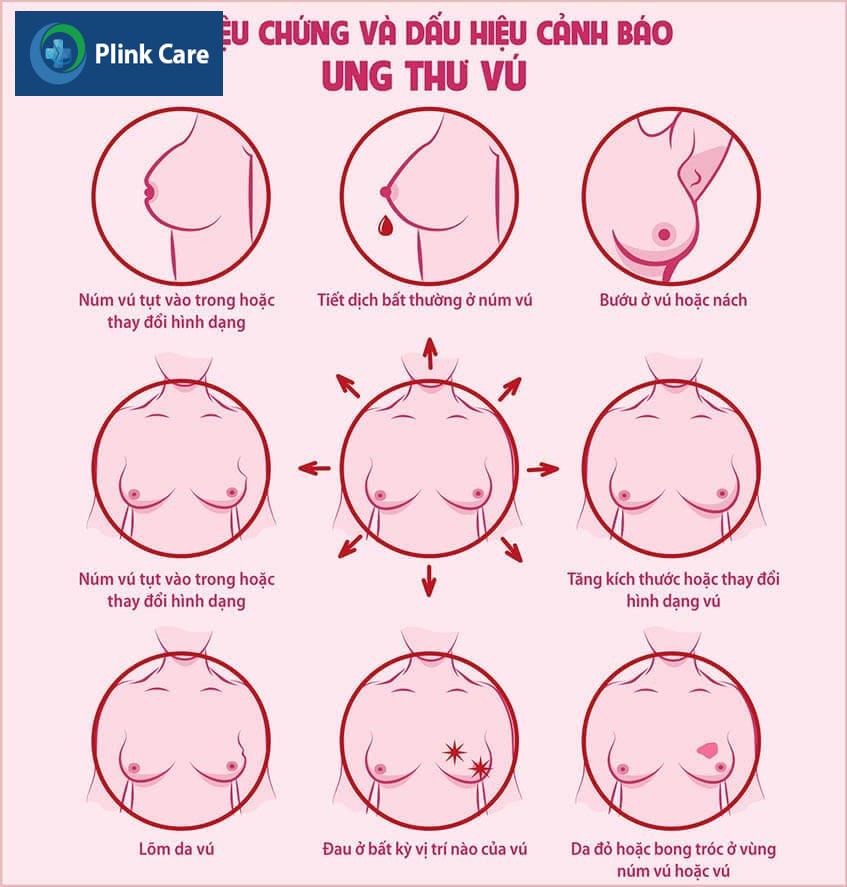 dấu hiệu bất thường ở tuyến vú
