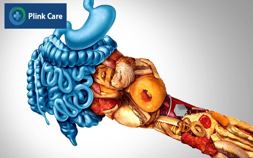 nguyên nhân hội chứng ruột kích thích