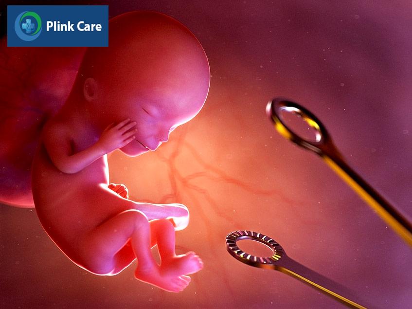 nạo phá thai nên được thực hiện tại cơ sở y tế uy tín