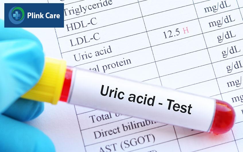 nồng độ acid uric cao